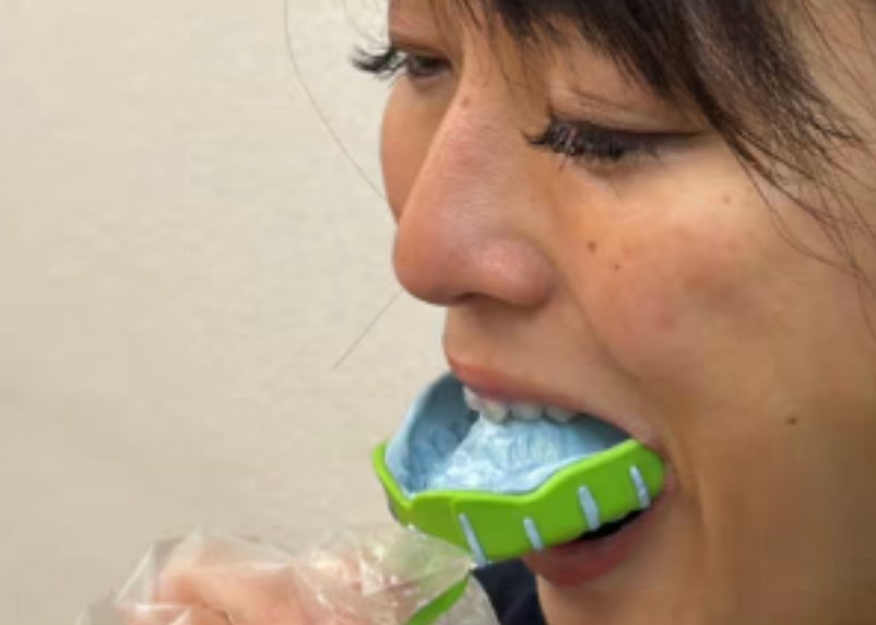 自宅でトレーを使って歯型を取っている様子